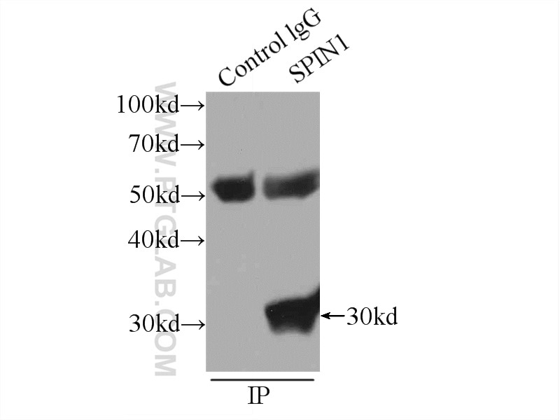 IP experiment of HeLa using 12105-1-AP