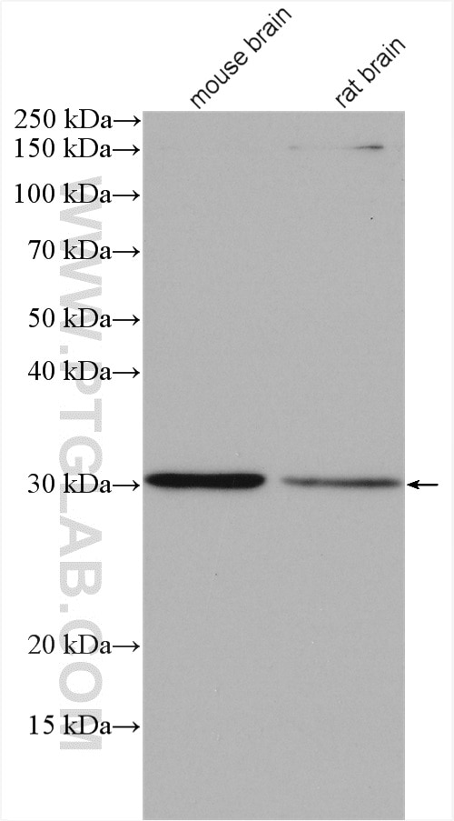Western Blot (WB) analysis of various lysates using SPIN1 Polyclonal antibody (12105-1-AP)
