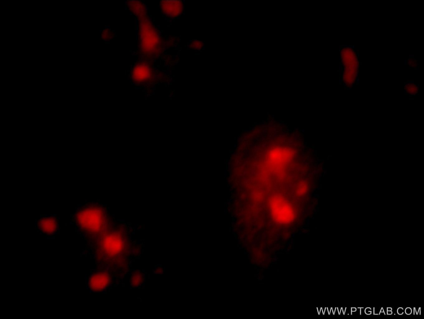 IF Staining of HeLa using 19531-1-AP