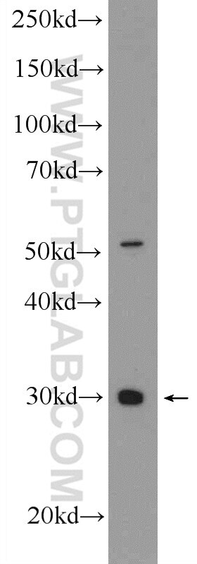 Western Blot (WB) analysis of A2780 cells using SPIN1-Specific Polyclonal antibody (19531-1-AP)