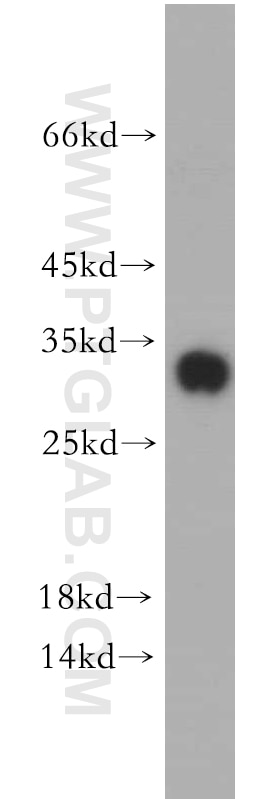Western Blot (WB) analysis of HEK-293 cells using SPIN1-Specific Polyclonal antibody (19531-1-AP)