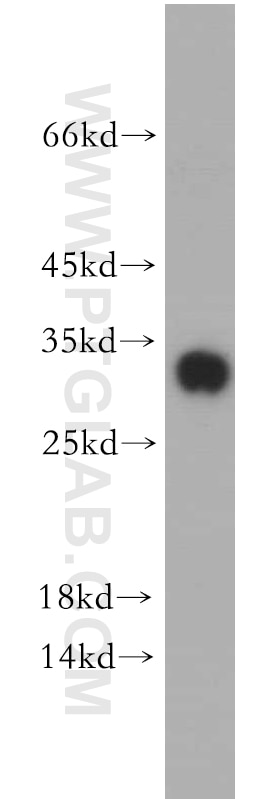 WB analysis of HEK-293 using 19531-1-AP