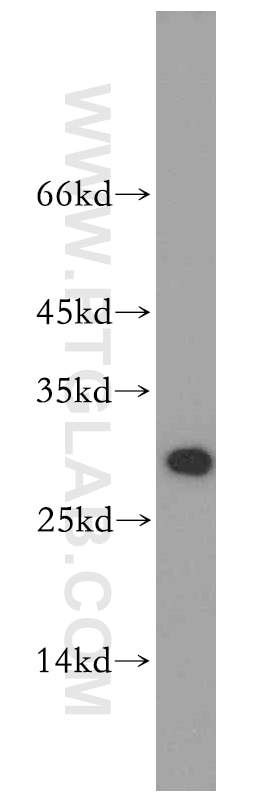 Western Blot (WB) analysis of SKOV-3 cells using SPIN1-Specific Polyclonal antibody (19531-1-AP)