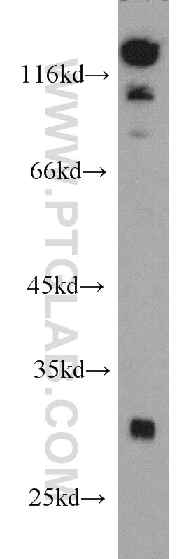 Western Blot (WB) analysis of mouse brain tissue using SPIN2B Polyclonal antibody (10107-2-AP)