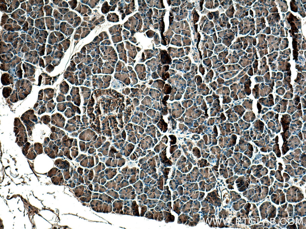 Immunohistochemistry (IHC) staining of human pancreas tissue using SPINK1 Polyclonal antibody (13477-1-AP)