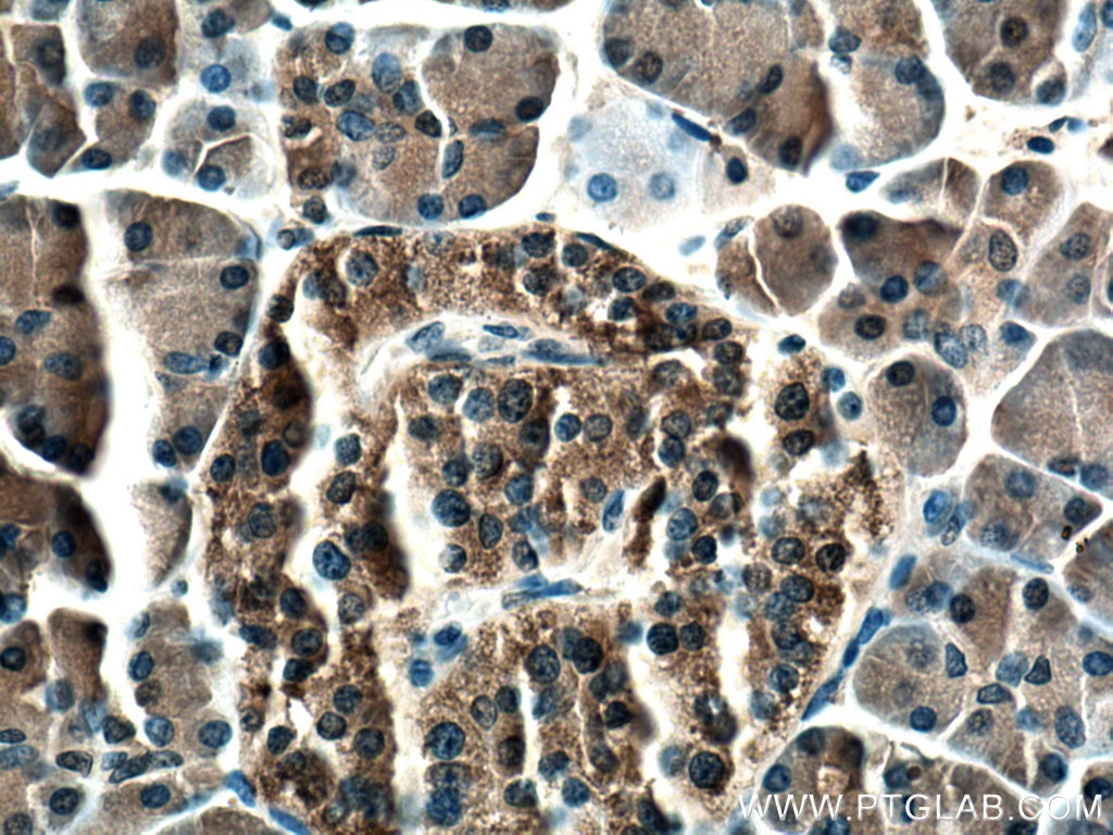 Immunohistochemistry (IHC) staining of human pancreas tissue using SPINK1 Polyclonal antibody (13477-1-AP)