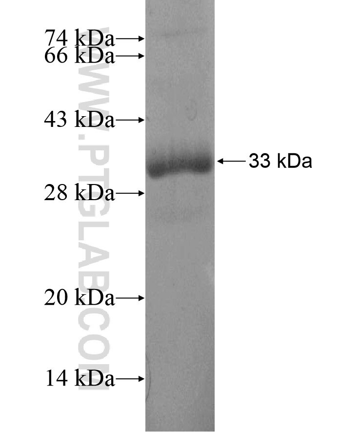 SPINK1 fusion protein Ag17131 SDS-PAGE
