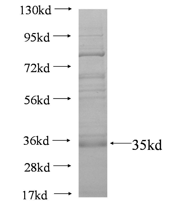 SPINK1 fusion protein Ag4344 SDS-PAGE