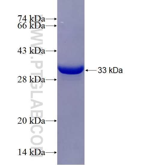 SPINK1 fusion protein Ag7931 SDS-PAGE