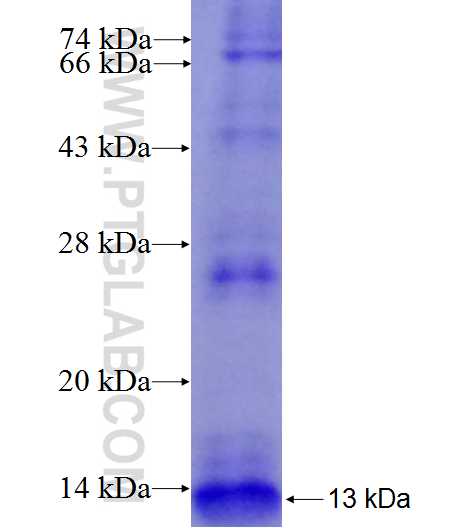 SPINK1 fusion protein Ag8027 SDS-PAGE
