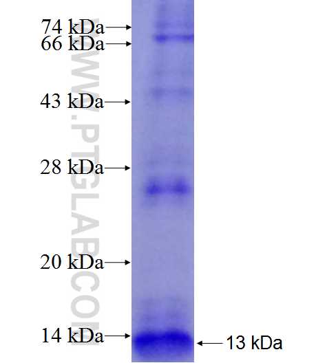 SPINK1 fusion protein Ag8027 SDS-PAGE SPINK1 fusion protein Ag8027 SDS-PAGE
