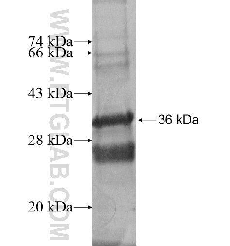 SPINK2 fusion protein Ag13560 SDS-PAGE SPINK2 fusion protein Ag13560 SDS-PAGE