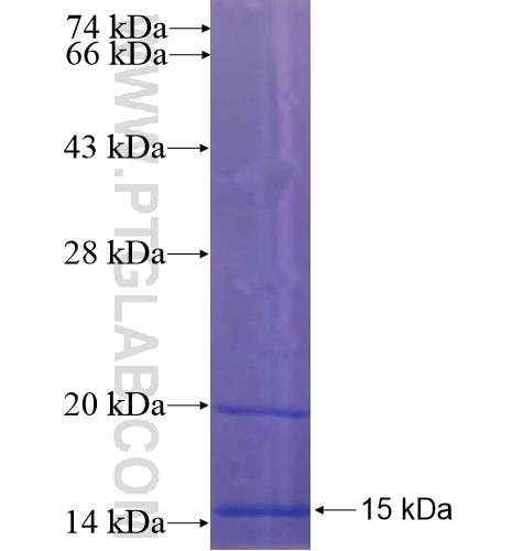 SPINK2 fusion protein Ag13642 SDS-PAGE SPINK2 fusion protein Ag13642 SDS-PAGE