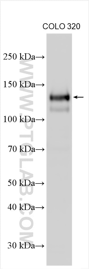 Western Blot (WB) analysis of COLO 320 cells using SPINK5 Polyclonal antibody (29808-1-AP)