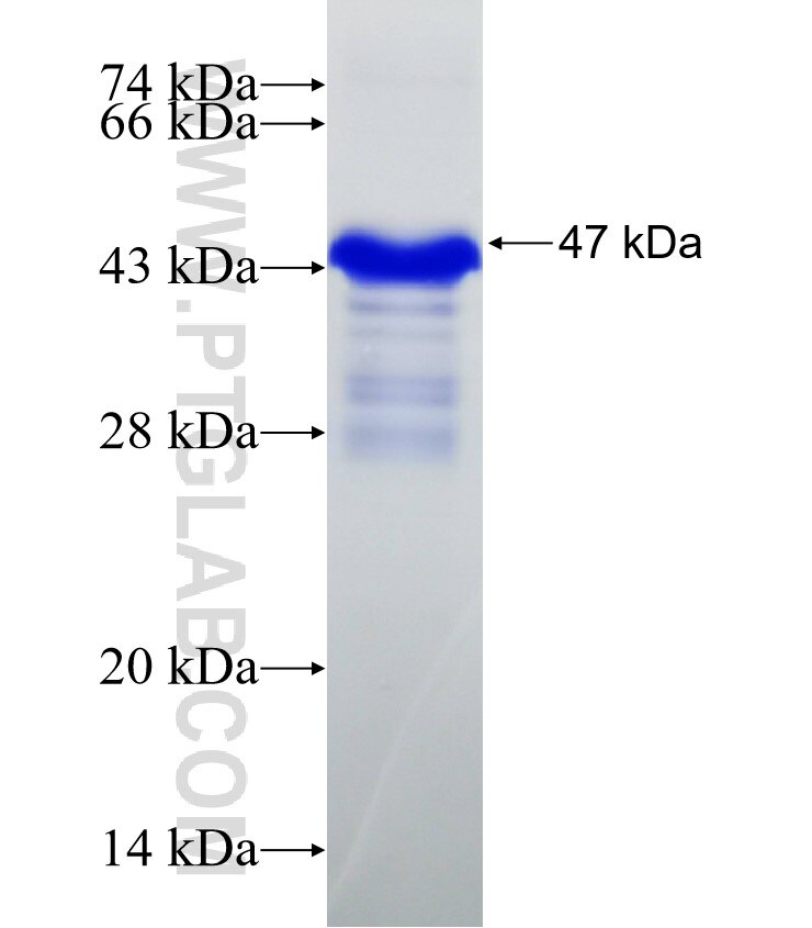 SPINK5 fusion protein Ag30432 SDS-PAGE