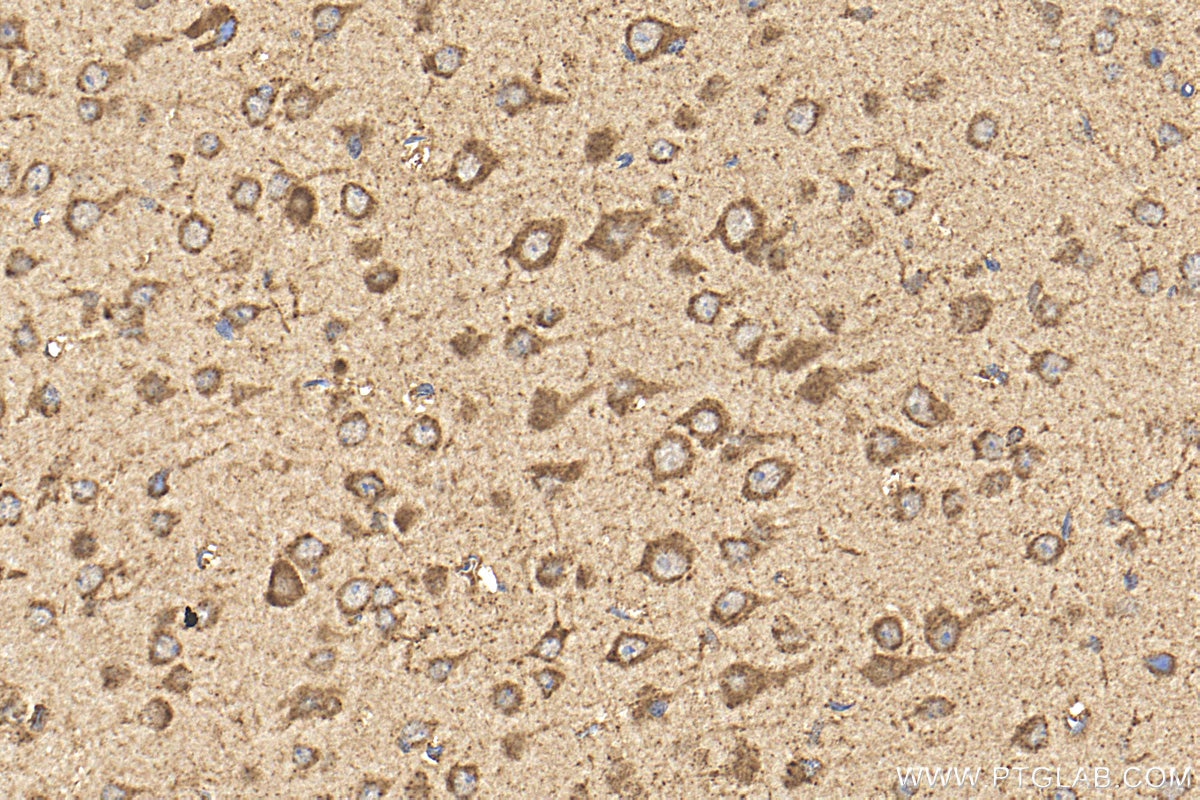 IHC staining of mouse brain using 24656-1-AP Immunohistochemistry (IHC) staining of mouse brain tissue using SPINK5L3 Polyclonal antibody (24656-1-AP)