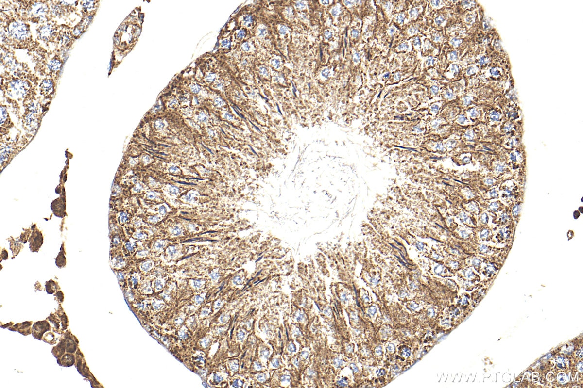 IHC staining of rat testis using 24656-1-AP Immunohistochemistry (IHC) staining of rat testis tissue using SPINK5L3 Polyclonal antibody (24656-1-AP)