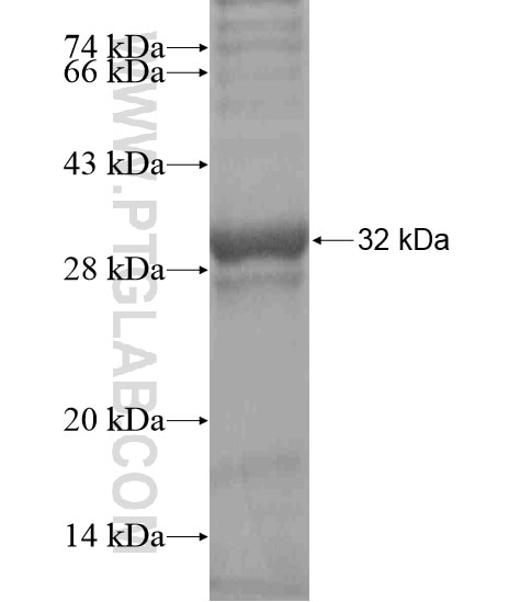 SPINK5L3 fusion protein Ag19715 SDS-PAGE SPINK5L3 fusion protein Ag19715 SDS-PAGE