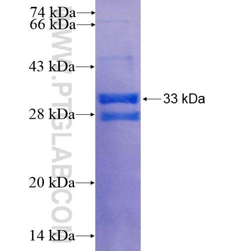 SPINK6 fusion protein Ag11392 SDS-PAGE