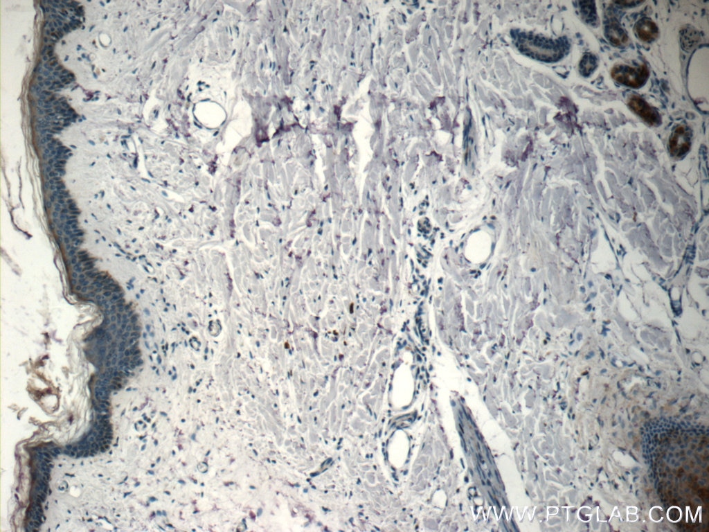 Immunohistochemistry (IHC) staining of human skin tissue using SPINK9 Polyclonal antibody (24661-1-AP)