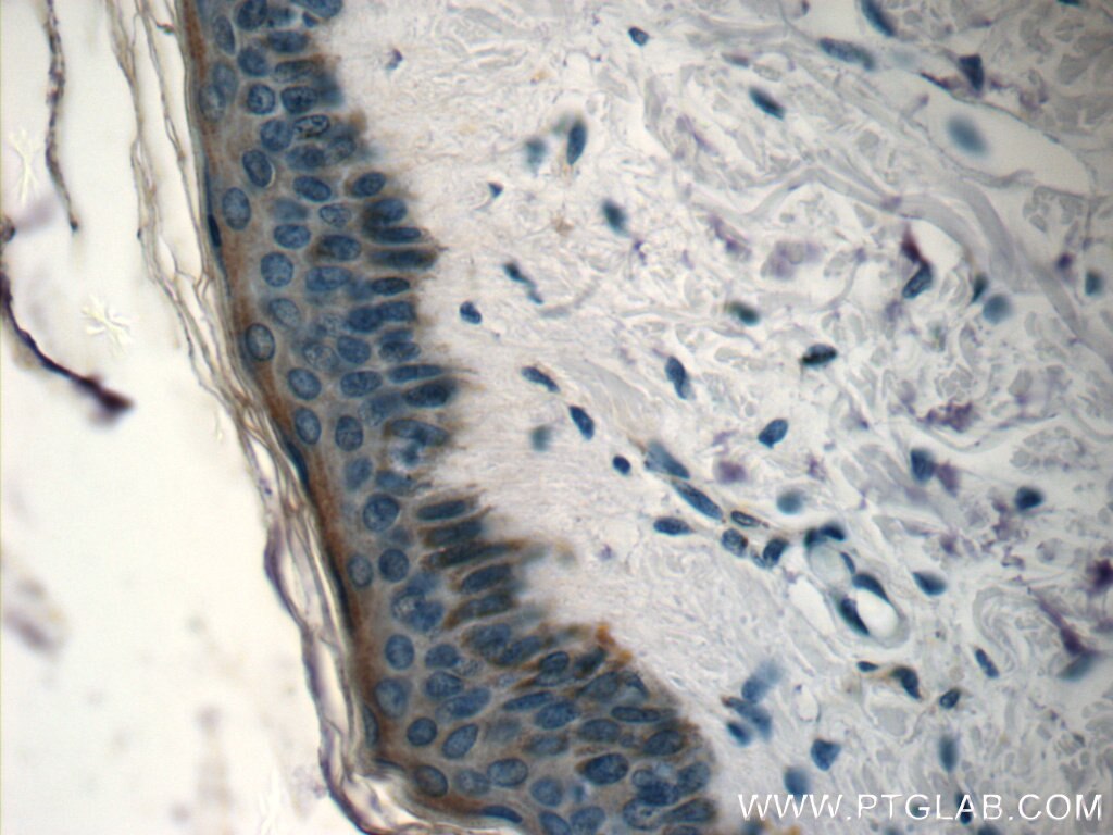 Immunohistochemistry (IHC) staining of human skin tissue using SPINK9 Polyclonal antibody (24661-1-AP)