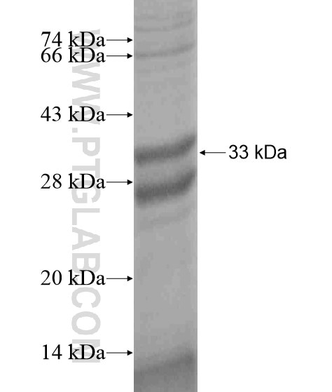 SPINK9 fusion protein Ag19719 SDS-PAGE SPINK9 fusion protein Ag19719 SDS-PAGE