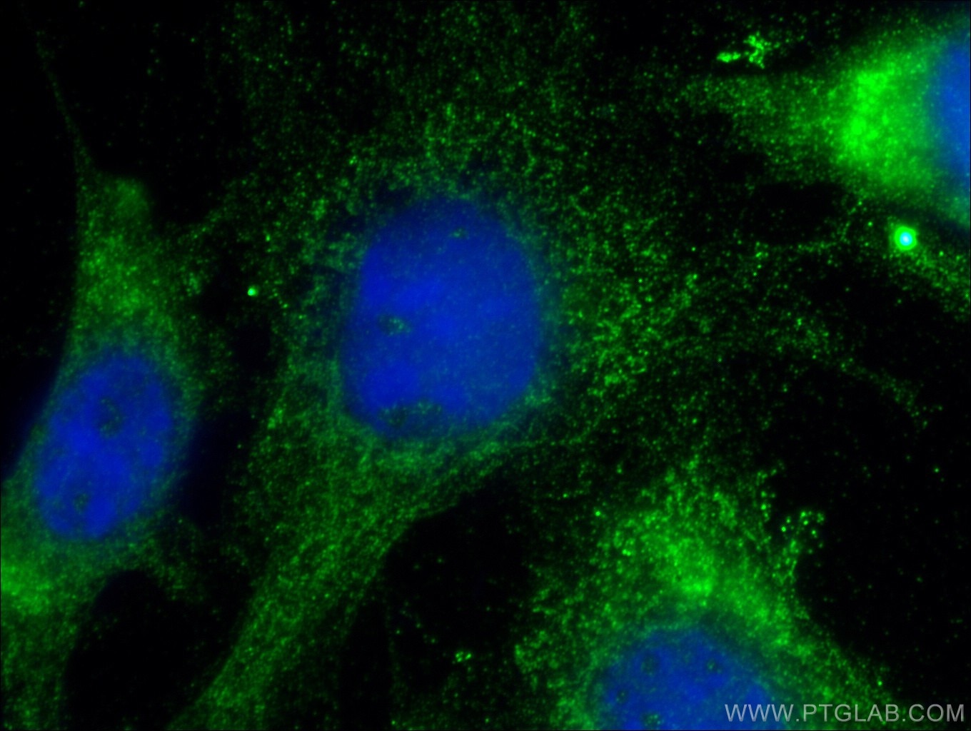 Immunofluorescence (IF) / fluorescent staining of NIH/3T3 cells using HAI-1 Polyclonal antibody (15036-1-AP)
