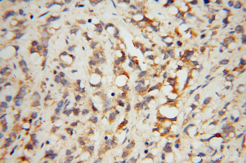 HAI-1 Polyclonal antibody