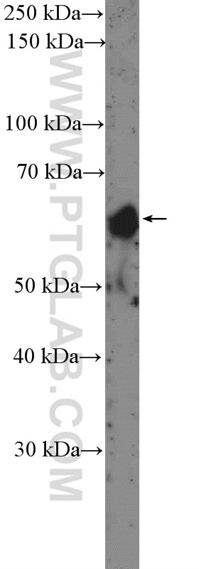 Western Blot (WB) analysis of human placenta tissue using HAI-1 Polyclonal antibody (15036-1-AP)