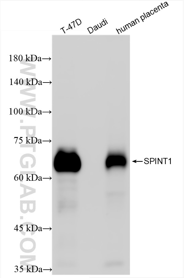 Western Blot (WB) analysis of various lysates using SPINT1/HAI-1 Recombinant antibody (86138-1-RR)