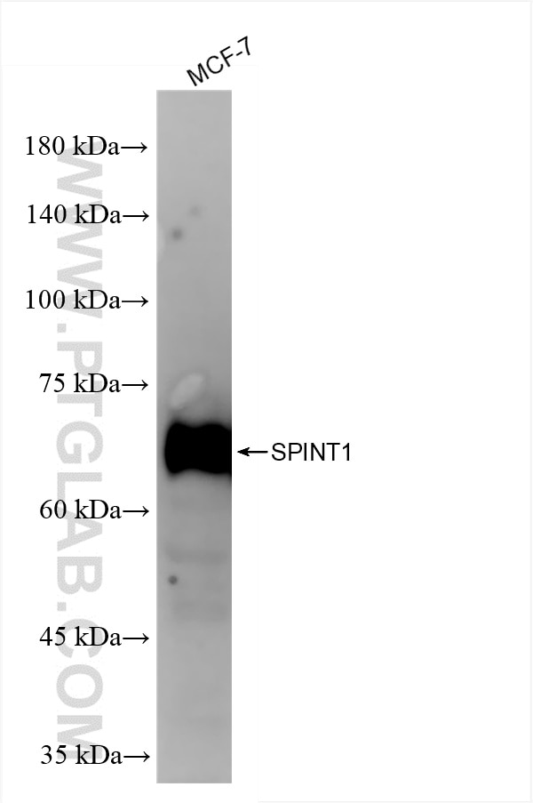 SPINT1/HAI-1
