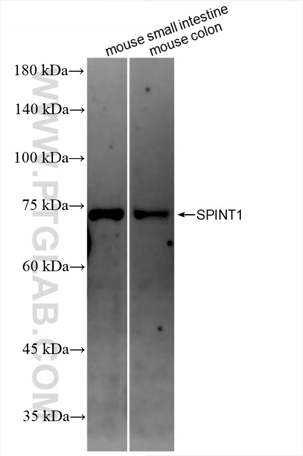 Western Blot (WB) analysis of various lysates using SPINT1/HAI-1 Recombinant antibody (86138-1-RR)