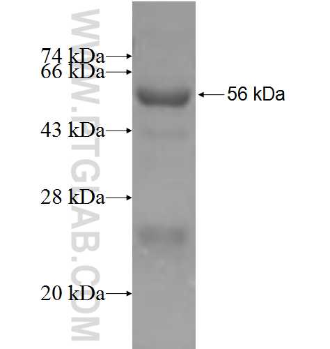 SPINT1 fusion protein Ag6665 SDS-PAGE