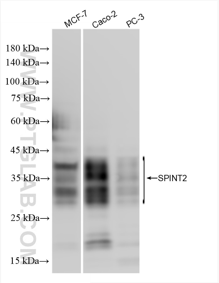 Western Blot (WB) analysis of various lysates using SPINT2/HAI-2 Recombinant monoclonal antibody (85684-6-RR)