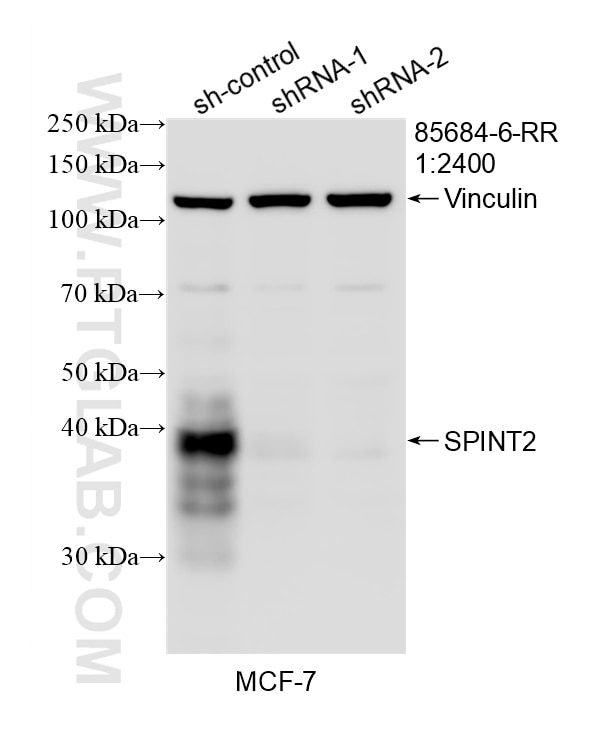 Western Blot (WB) analysis of MCF-7 cells using SPINT2/HAI-2 Recombinant monoclonal antibody (85684-6-RR)
