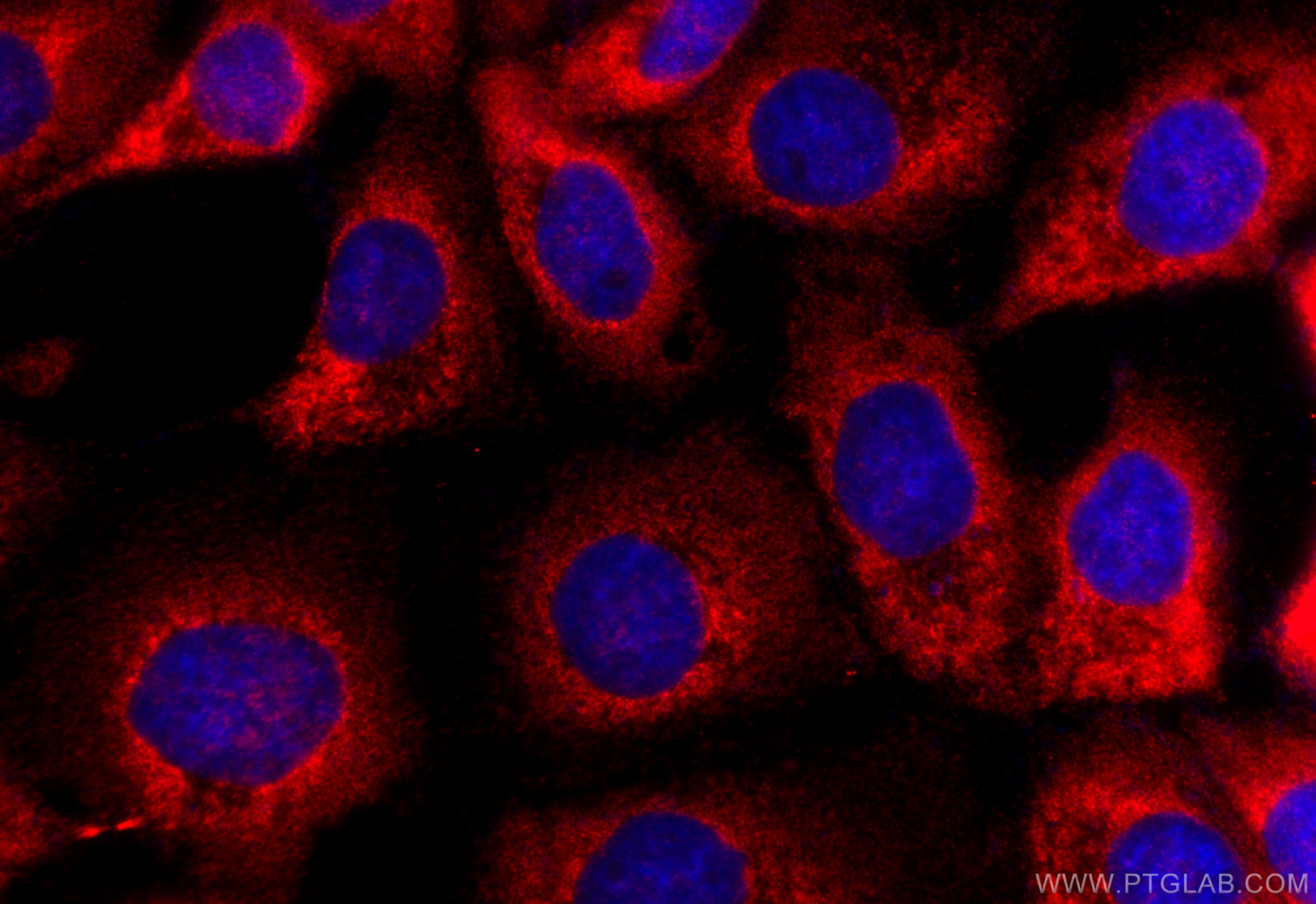 Immunofluorescence (IF) / fluorescent staining of A431 cells using SPINT3 Polyclonal antibody (31931-1-AP)