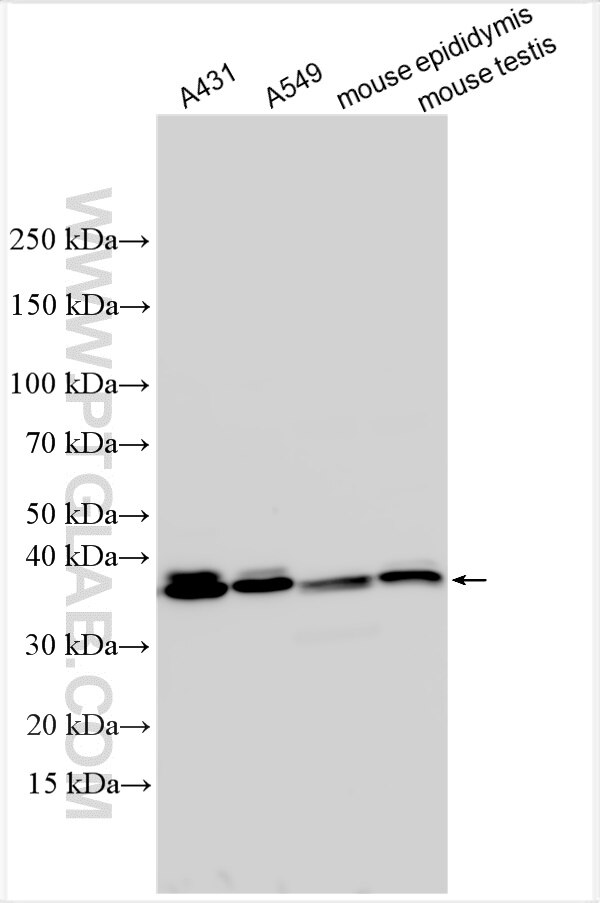 Western Blot (WB) analysis of various lysates using SPINT3 Polyclonal antibody (31931-1-AP)