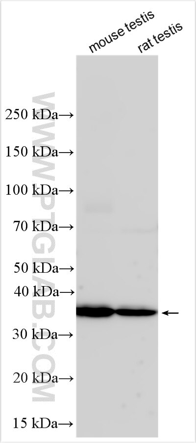 Western Blot (WB) analysis of various lysates using SPINT3 Polyclonal antibody (31931-1-AP)