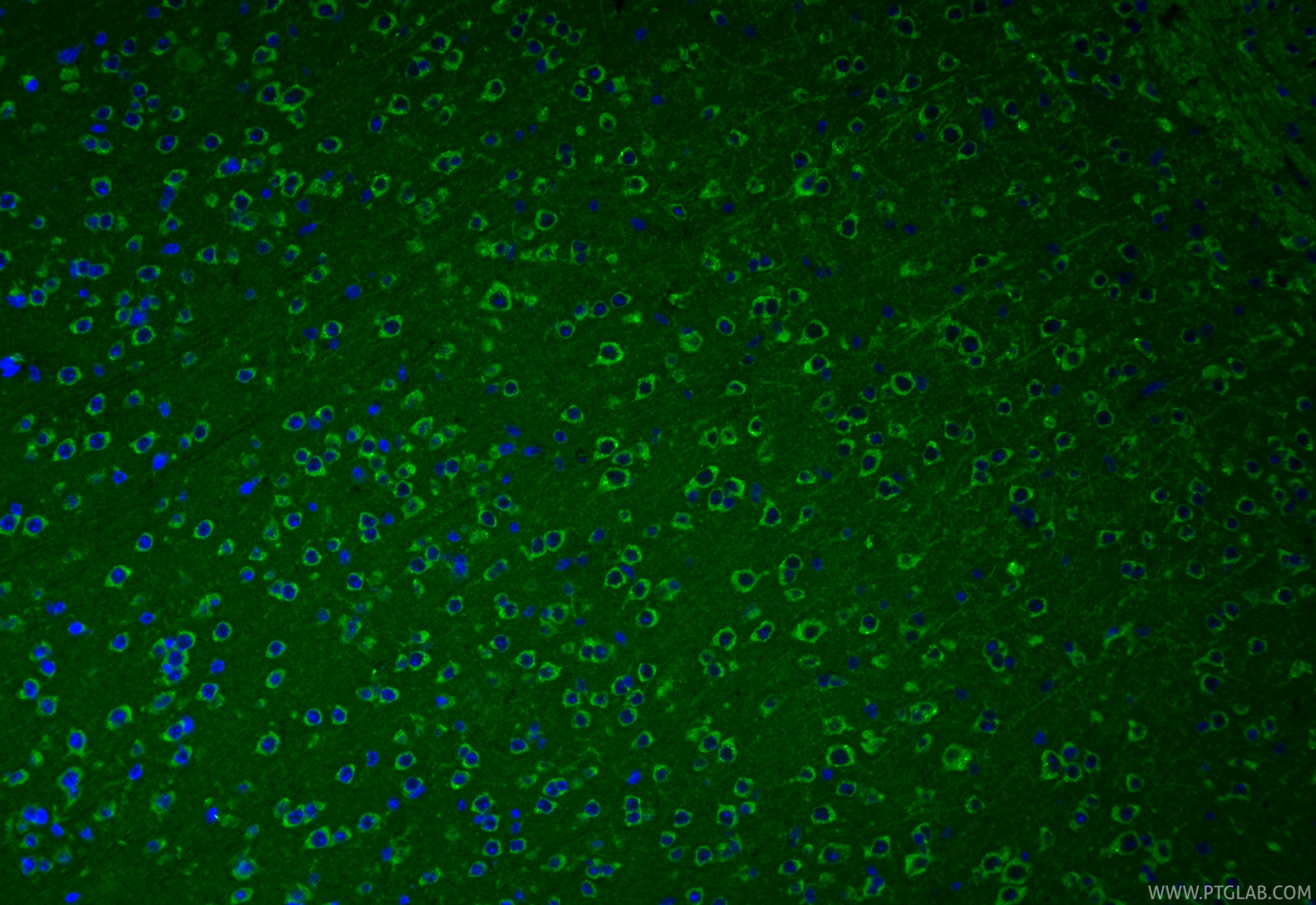 IF Staining of mouse brain using 11295-1-AP Immunofluorescence (IF) / fluorescent staining of mouse brain tissue using SPIRE1 Polyclonal antibody (11295-1-AP)