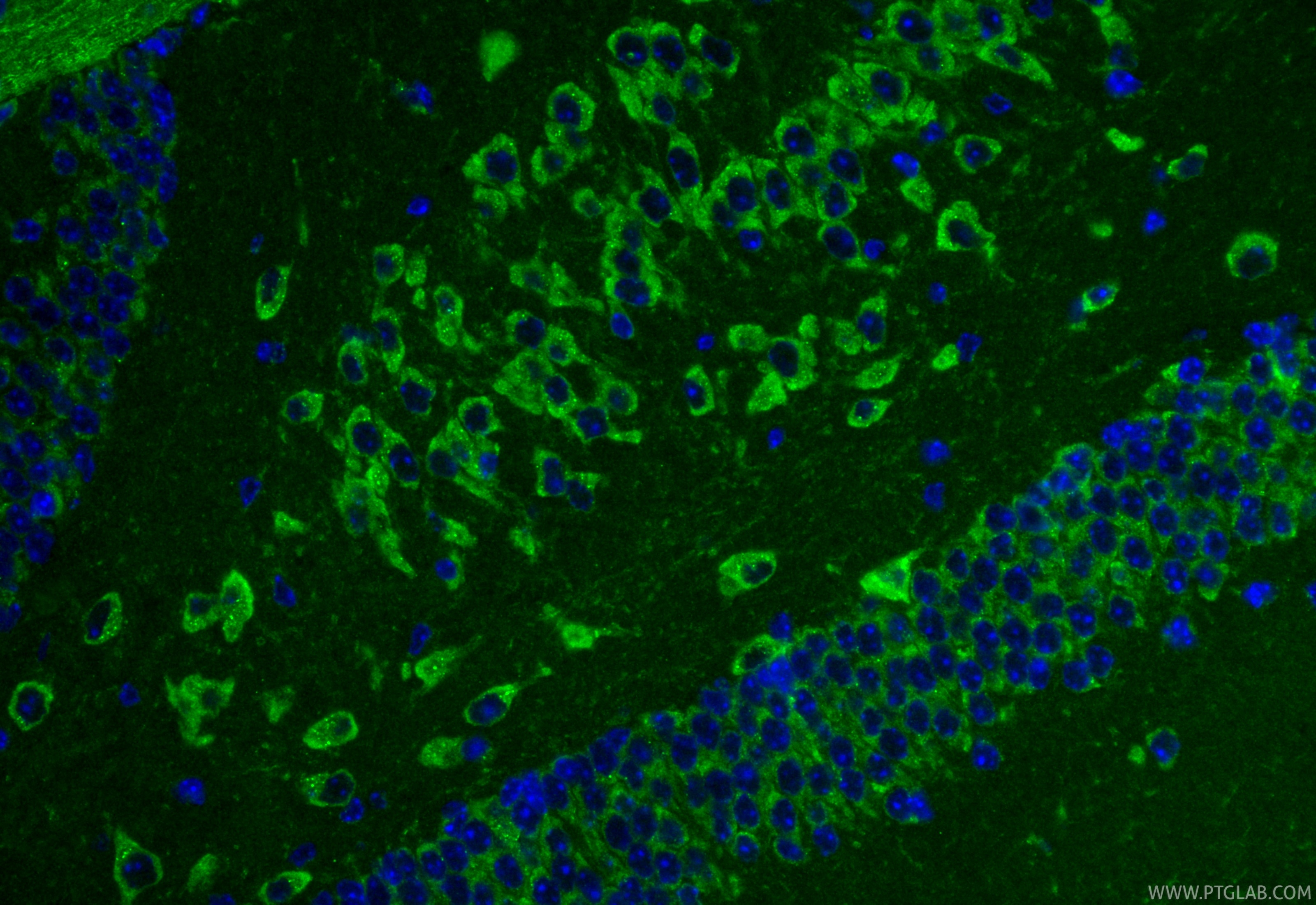 IF Staining of mouse brain using 11295-1-AP Immunofluorescence (IF) / fluorescent staining of mouse brain tissue using SPIRE1 Polyclonal antibody (11295-1-AP)