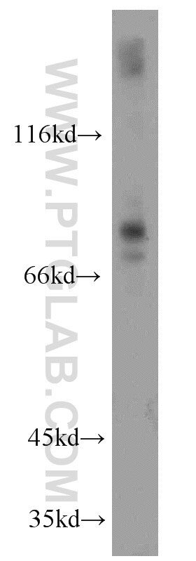 Western Blot (WB) analysis of mouse cerebellum tissue using SPIRE2 Polyclonal antibody (17757-1-AP)