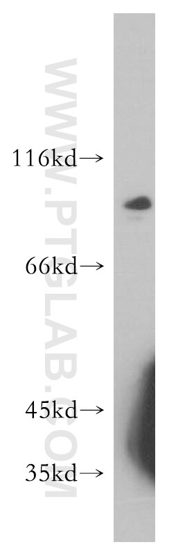 Western Blot (WB) analysis of mouse cerebellum tissue using SPIRE2 Polyclonal antibody (17757-1-AP)