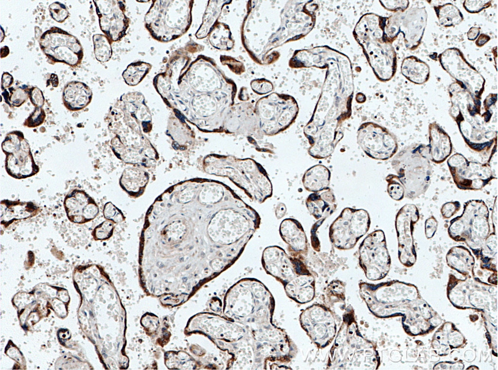 IHC staining of human placenta using 16110-1-AP