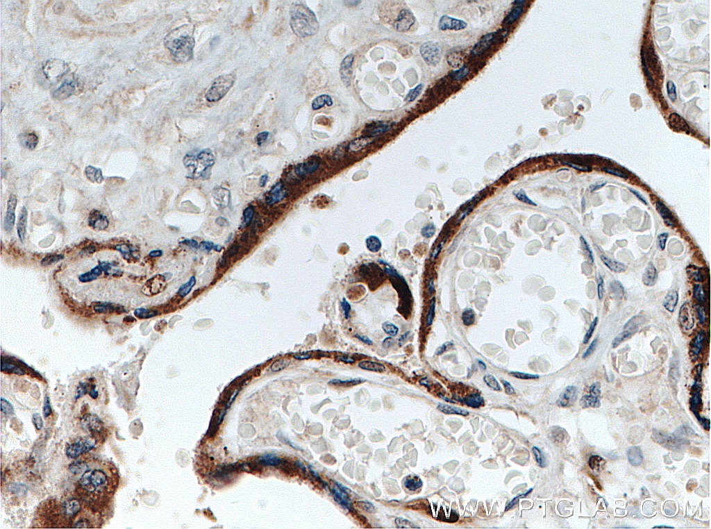 IHC staining of human placenta using 16110-1-AP