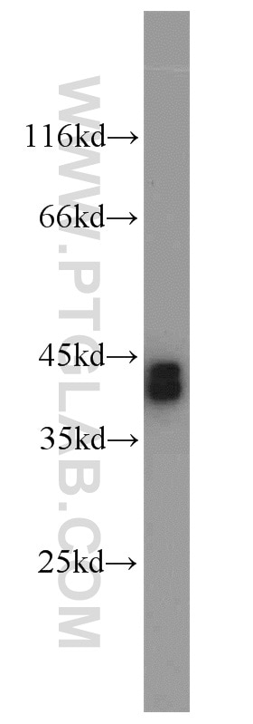 WB analysis of mouse testis using 16110-1-AP