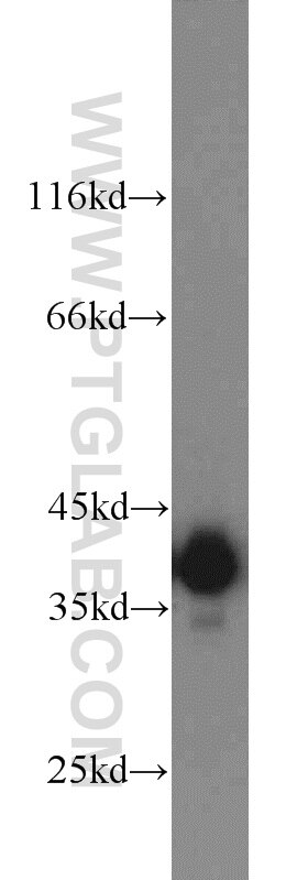 Western Blot (WB) analysis of Jurkat cells using PBK Polyclonal antibody (16110-1-AP)
