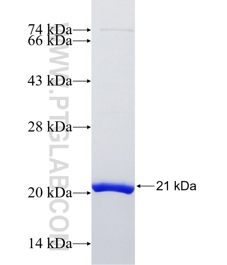 SPMIP10 fusion protein Ag37816 SDS-PAGE SPMIP10 fusion protein Ag37816 SDS-PAGE