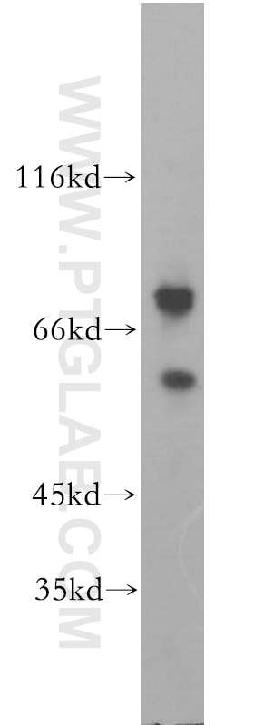Western Blot (WB) analysis of Jurkat cells using CD43 Polyclonal antibody (13959-1-AP)