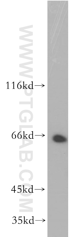 Western Blot (WB) analysis of K-562 cells using CD43 Polyclonal antibody (13959-1-AP)