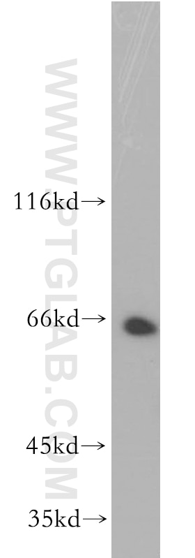 WB analysis of K-562 using 13959-1-AP